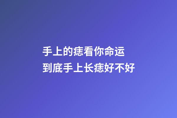 手上的痣看你命运 到底手上长痣好不好